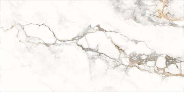 Global Tile Marigold  30x60 -2